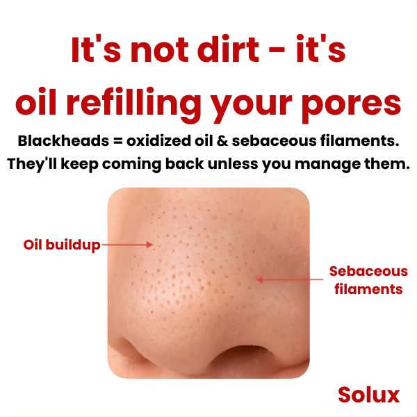 Solux Porelift™